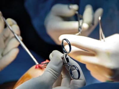 Brustverkleinerung: Expertenberatung und Chirurgie im Herzen von NRW
